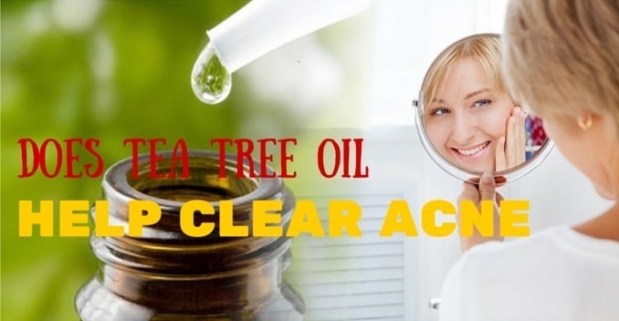 does tea tree oil help acne