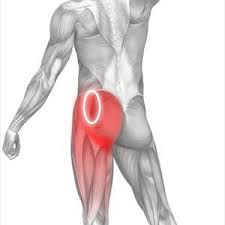 sciatica pain relief