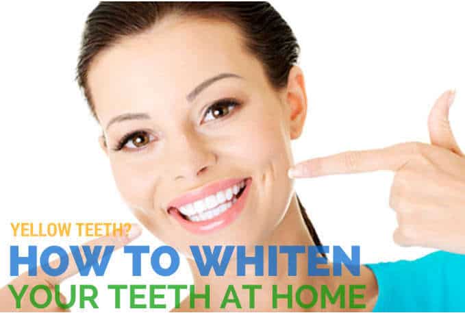 whiten-yellow-teeth