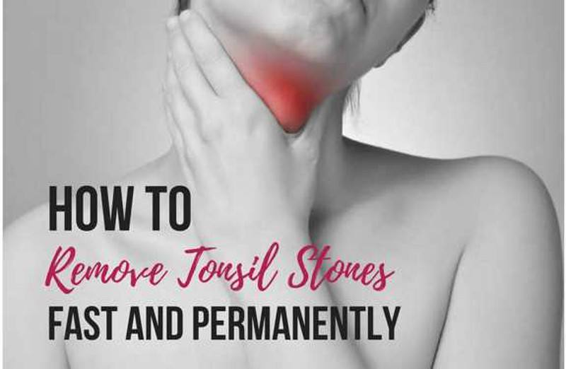 how to get rid of tonsil stones